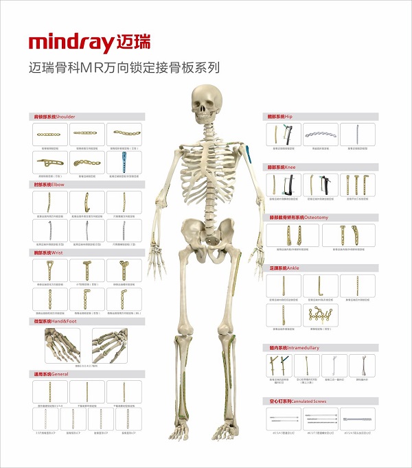 MR万向锁定接骨板系列